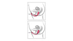 Love Egg & Clitoral Vibrator με Τηλεχειριστήριο – RC Double Pleasure Love Ball Sweet Smile-4024144228096